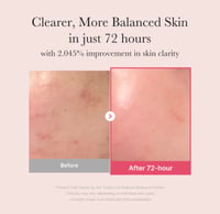 Medicube TXA Niacinamide Serum - Image 5