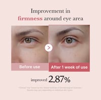 Medicube PDRN Pink Peptide Eye Cream - Image 4