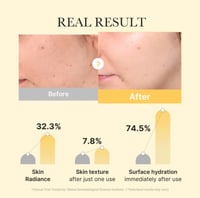 Medicube Kojic Acid Turmeric Gold Jelly Gel Mask - Image 3