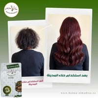 اشتري 8 عبوات حنا المدينه واحصل على عبوتين هدية مع شحن مجاني | متجر حنا المدينة - صورة 5