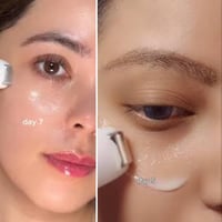 Dr. Althea Retinol Eye Roller – Firming & Smoothing Eye Care 25ml - Image 3