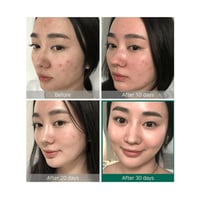 تونر سوم باي مي AHA BHA PHA لتنقية وتقشير البشرة بلطف - 150 مل - صورة 3