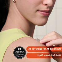 Hero Mighty Patch Surface 10PCS  - Image 7