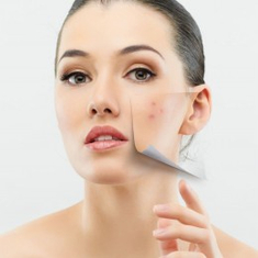 العناية بالبشرة الدهنية وحب الشباب | Care for oily skin and acne