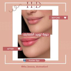 تفتيح وتوريد