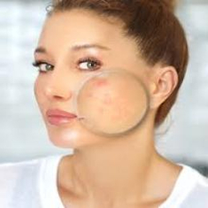Sensitive Skin