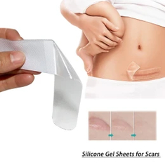 Body Scars
