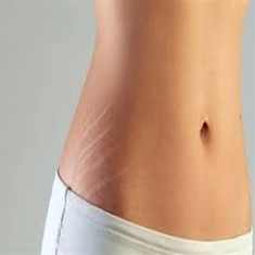 Firming & Stretch Marks