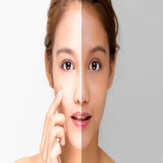 Skin Whitening & Bright