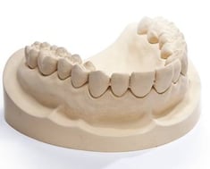 Plaster dento-stone® 220 type 4 