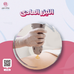 ازالة الشعر بالليزر