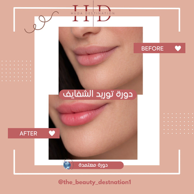 تفتيح وتوريد