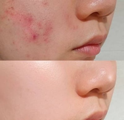 Some By Mi Miracle 30 Day Cream AHA-BHA-PHA, 60g