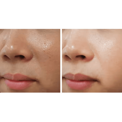 ACM Brightening Cream, Anti-Brown Spots, Evens Skin Tone, 40ml