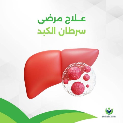 فرصة تبرع لعلاج مرضى سرطان الكبد