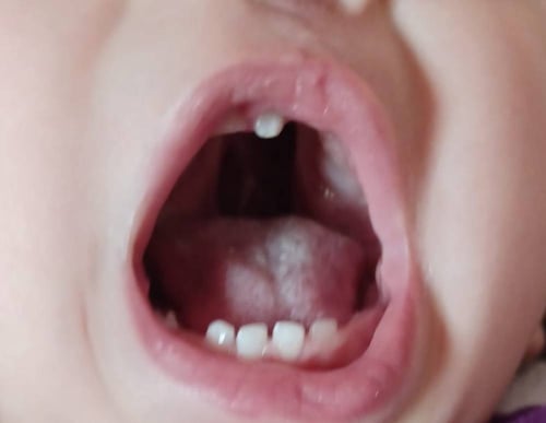 الطفله (س.أ)