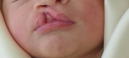 الطفله (ر،ع)