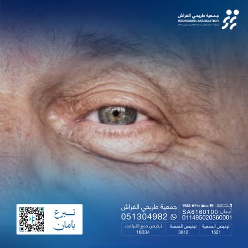 كُن سبباً ليستعيد بصره