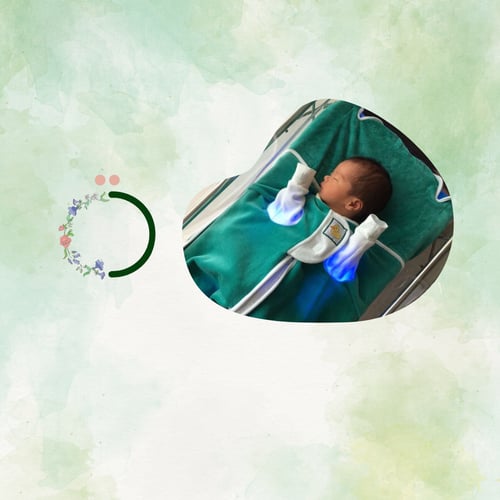 استئجار جهاز الصفار ( اليرقان )