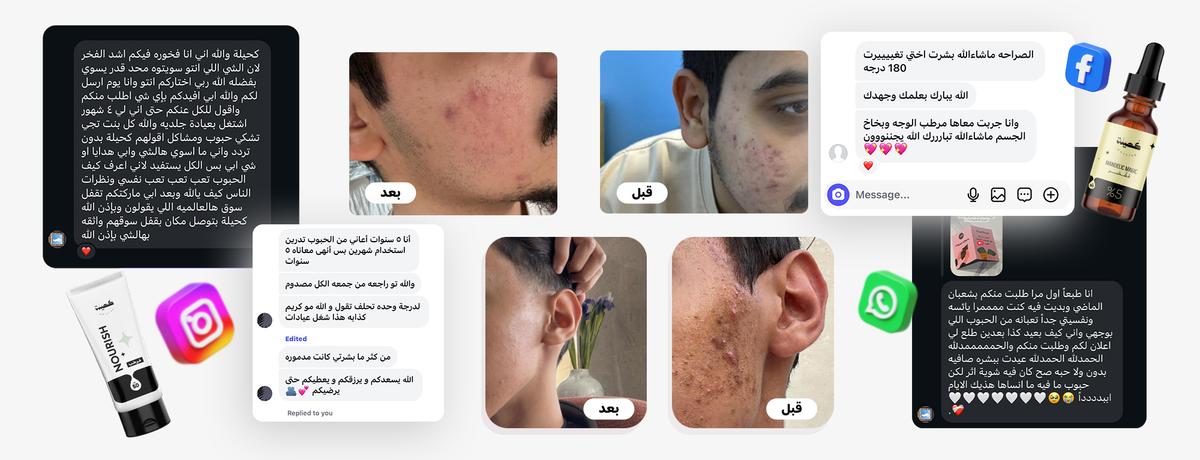 نهاية معاناة البشرة تبدأ من هنا👌🏻😍