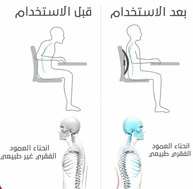  أداة مساج الظهر - متعددة الخيارات 