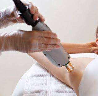 ثلاث جلسات ليزر ازالة شعر ابط +رتوش