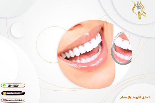 خدمات اسنان يمكنك الدفع بعد زيارة الدكتور من هنا 