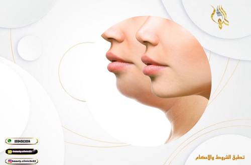 ثلاث جلسات فراكس برو ليزر الفراكشنال 