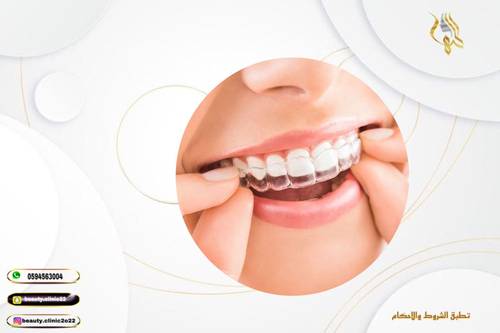 المثبت المتحرك الشفاف بعد التقويم (فك)