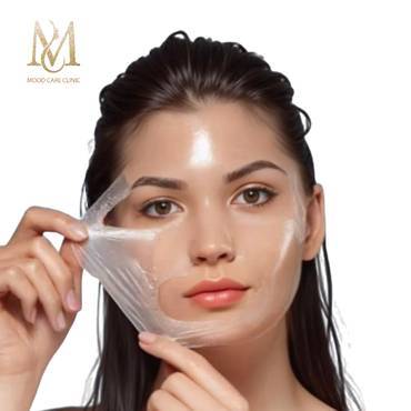 Cold Peeling (Simel with home care cream)