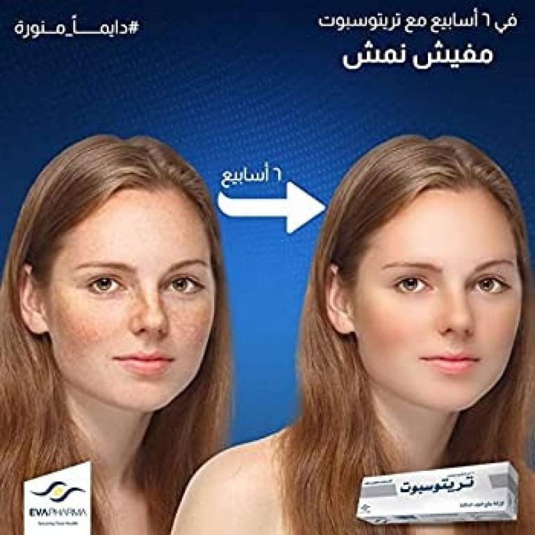 Tritospot cream to remove dark spots 15g
