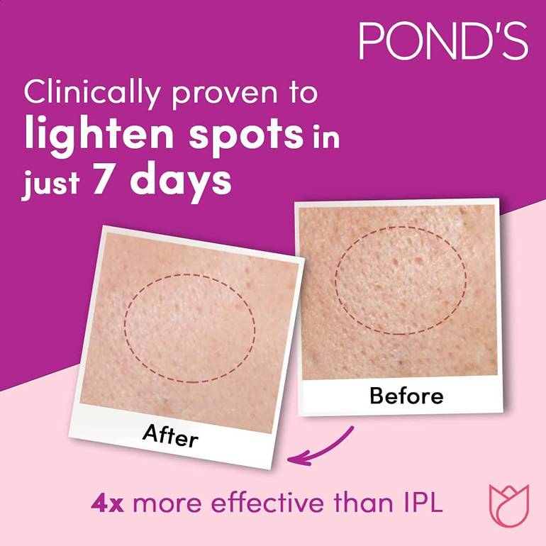 Pond's, Flawless Radiance, Skin Perfecting Day Cream, 50ml