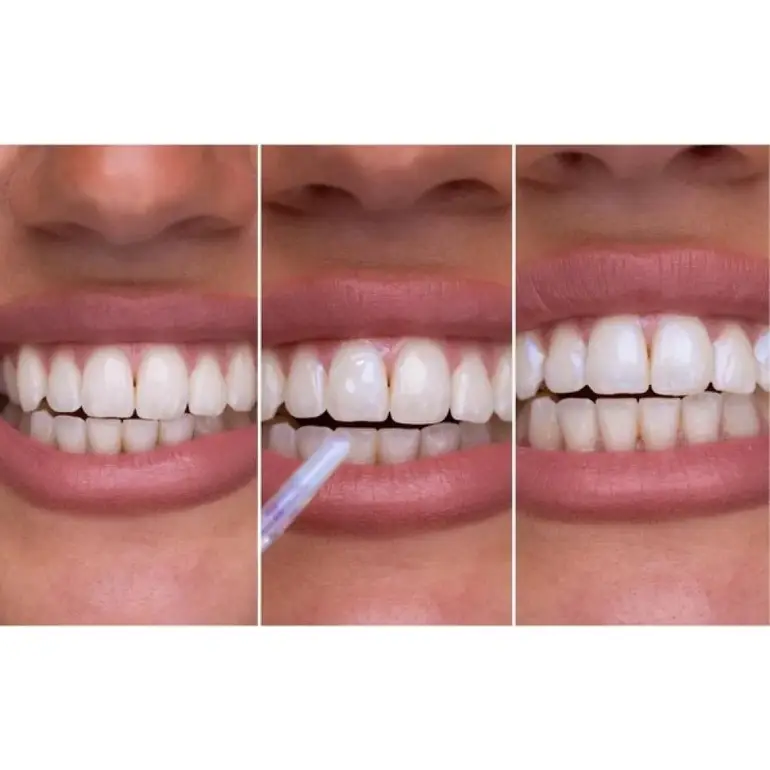 Hismile, Glostik Tooth Gloss, – 4 ml 