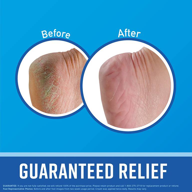 O'Keeffe's, Healthy Feet Blue Moisturizing Foot Cream