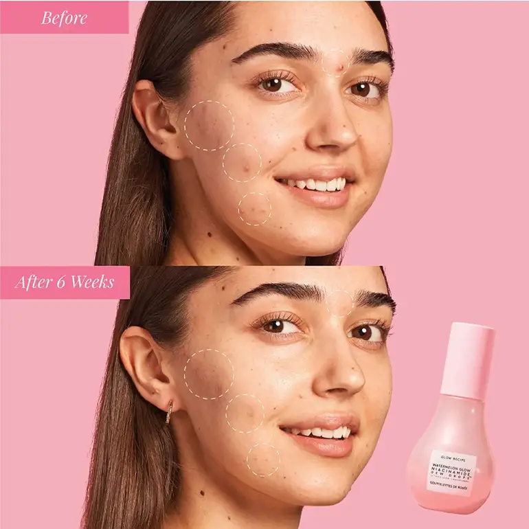 Glow Recipe, Watermelon Hydrating Facial Serum, and Pigmentation Treatment