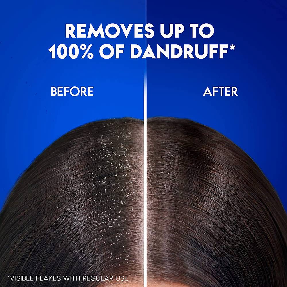 Head & Shoulders Smooth & Silky Anti-Dandruff Shampoo - 350ml |Rozy