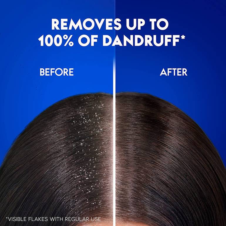 Head & Shoulders Smooth & Silky Anti-Dandruff Shampoo - 350ml |Rozy