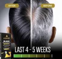 Alvanso Black Hair Shampoo - 350ml 