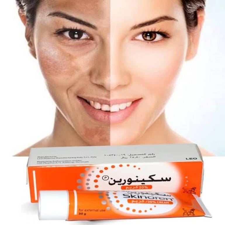 Skinoren, cream, for whitening, lightening, skin, and removing ,acne