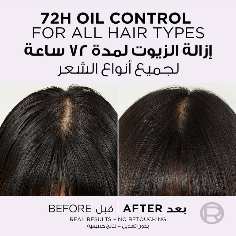 L'Oreal, Rehydrating Conditioner, Oily Scalp, - 360ml