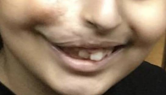 الطفله (ر،غ)