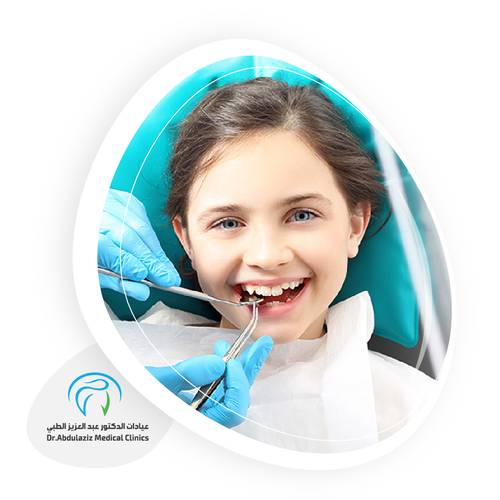 علاج عصب الأسنان تبدأ من