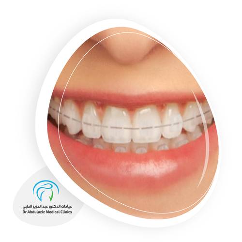 التركيبات الزريكون والايماكس تبدأ من