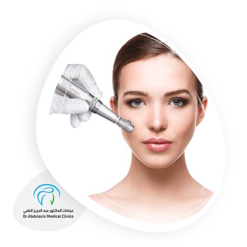 ليزر منطقة الشنب + رتوش