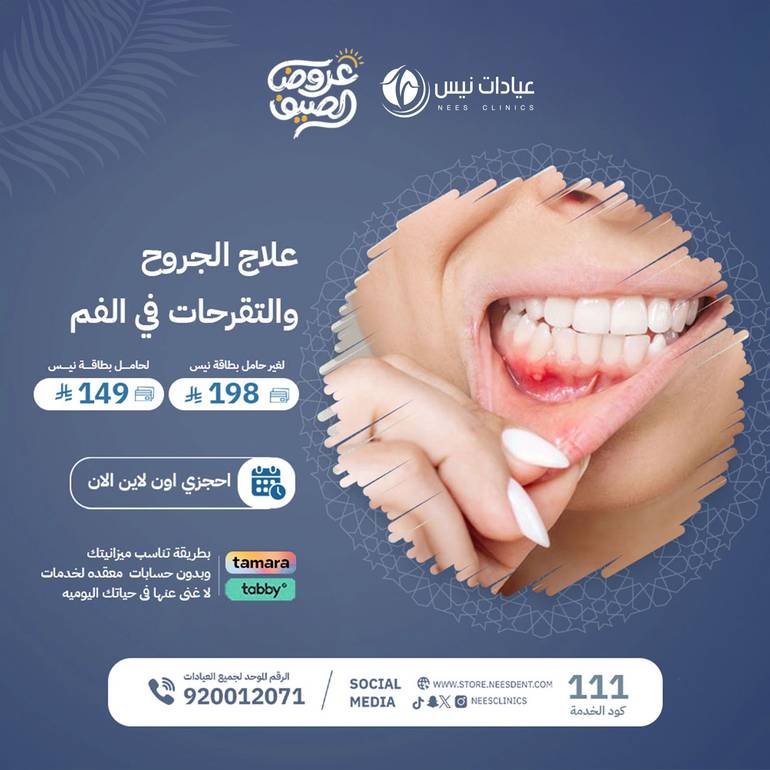 علاج الجروح والتقرحات في الفم