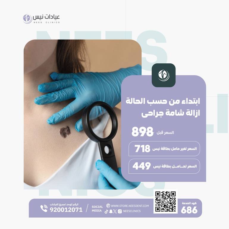 (ابتداء من ... حسب الحالة)ازالة شامة جراحى