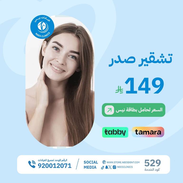 تشقير صدر