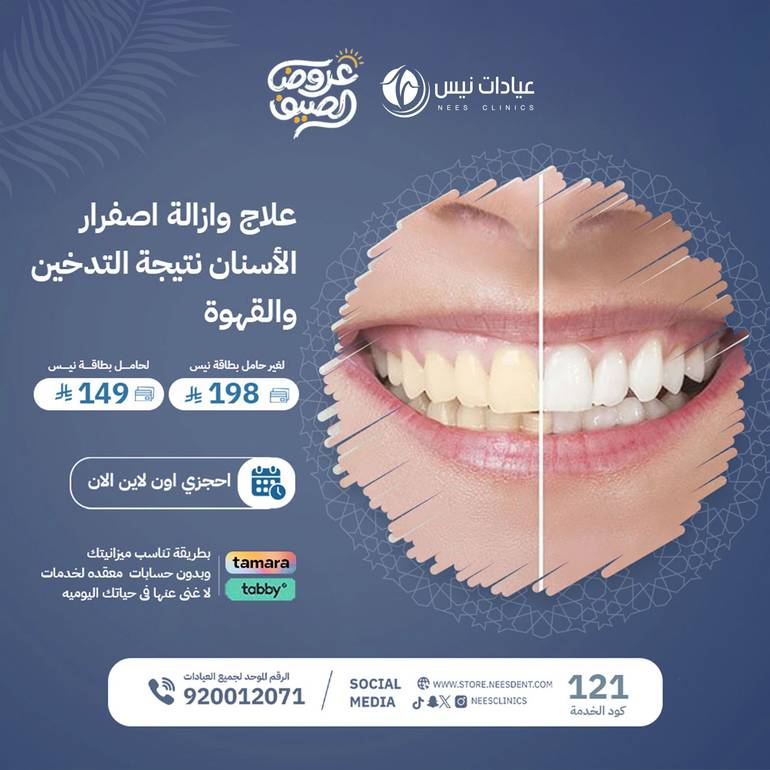 علاج وازالة أصفرار في الأسنان المترتبه على التدخين وشرب القهوه  كثيرا 