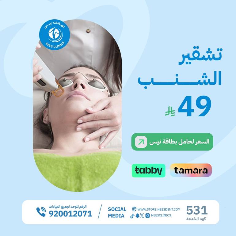 تشقير الشنب