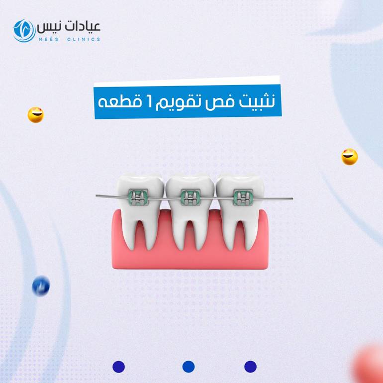 نثبيت فص تقويم 1 قطعه